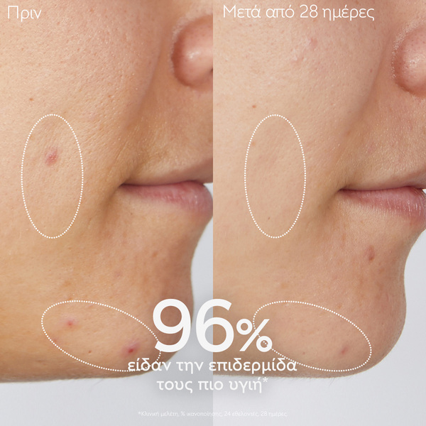 CAUDALIE - VINOPURE Gelee Nettoyante Purifiante - 150ml Combination/ Acne Prone Skin